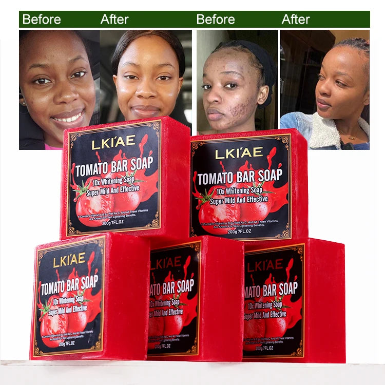 Private Label 10x Whitening Soap Handmade 2-Pack Natural Tomato Cleanse Dark Spot Even Tone Brightening Soap for Instant Glow