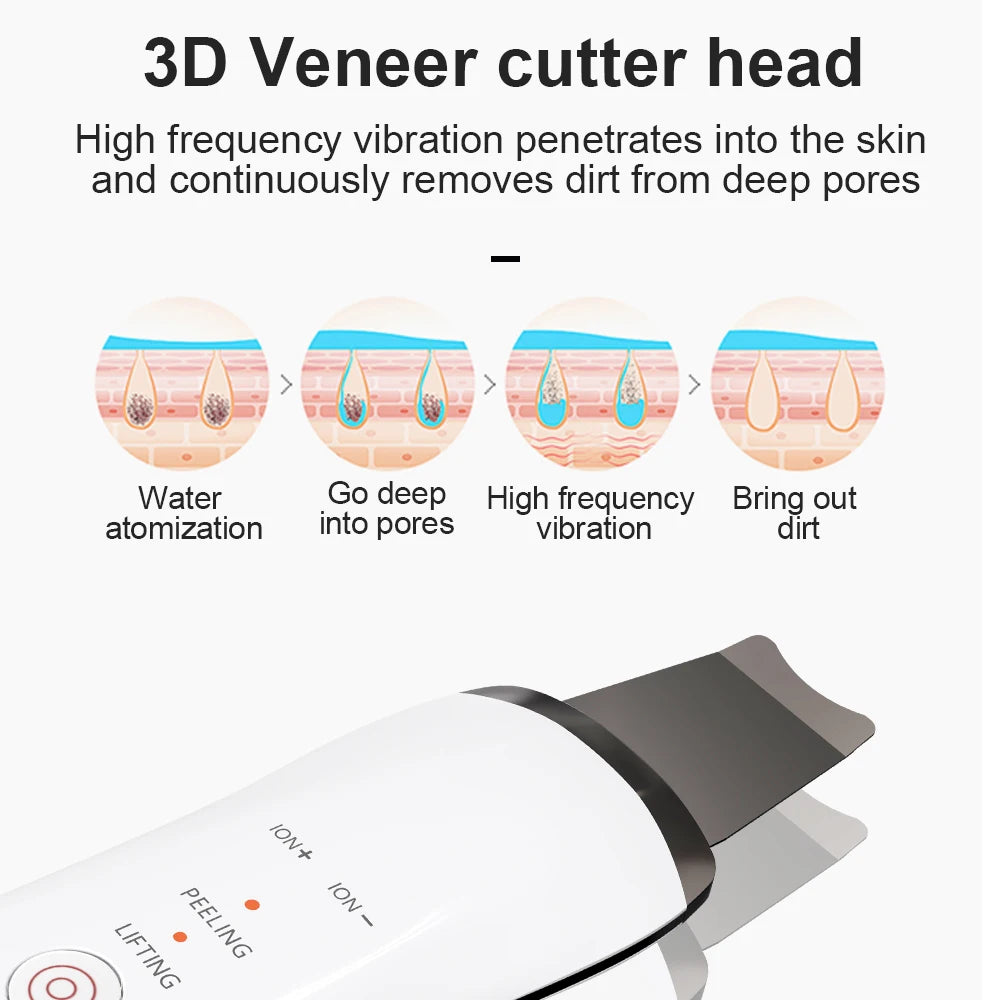 Portable Electric Ultra-Sonic Skin Scrubber Facial Dead Skin Peeler & Cleaning Device Facile Face Peeling Machine