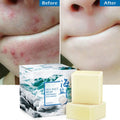 Sea Salt Soap Whitening Moisturizing Wash Base Removal Pimple Pores Acne Treatment Face Care Wash Basis Soap Shower